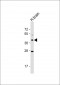 OR5M8 Antibody (C-term)